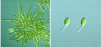 Жёлто-зелёные водоросли - одноклеточные, колониальные и многоклеточные